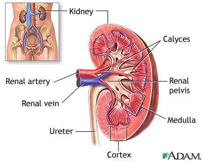 Home Remedy For Kidney Stones