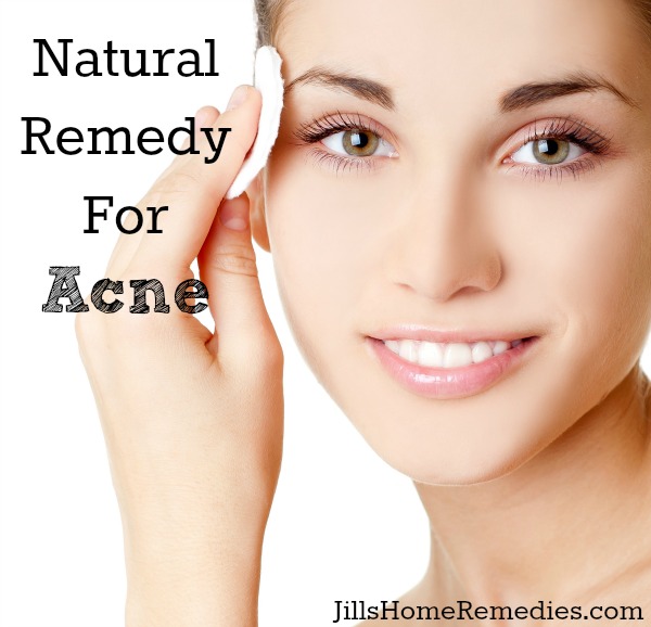 Natural Remedy For Acne