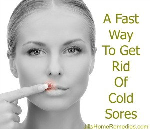 A Fast Way To Get Rid Of Cold Sores